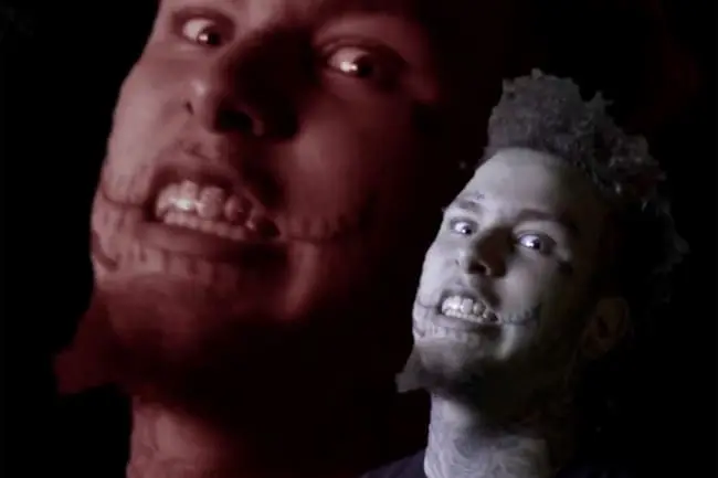 Stitches – Kilos In My Bag [Video]